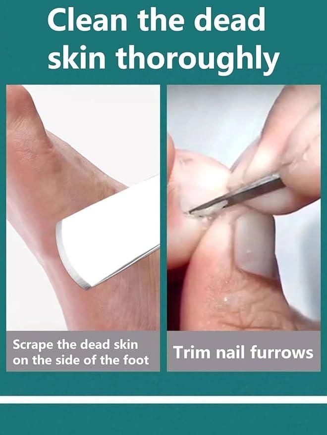 5 Piece Pedicure Tool Set with Storage Case - Complete Pedicure Kit - Eazylife India